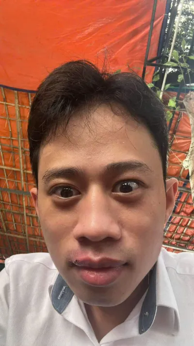 ảnh meme troll Trẻ trâu anh Long trợn mắt tỏ vẻ ngầu